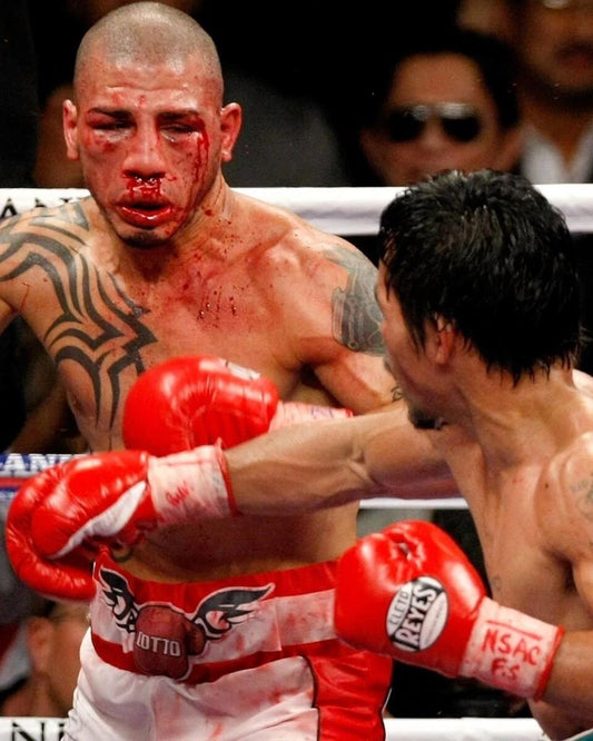 Manny Pacquiao Vs Miguel Cotto Keychain Boxing Picture Bloody Action