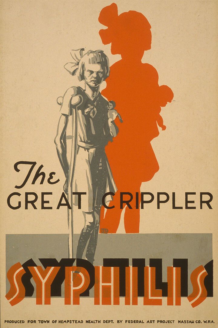 Young Girl With Syphilis Vintage 1936 Wpa Public Health Wall Poster